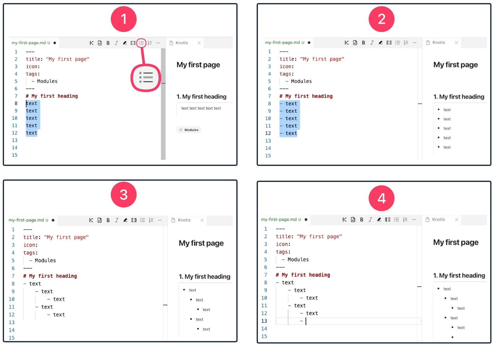 Using the Bullet List icon in the Knotis VS Code extension.